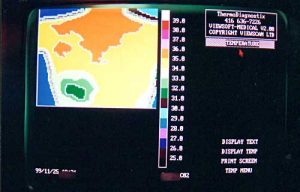 Thermotex upper back thermography 1