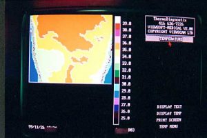 Thermotex upper back thermography 2